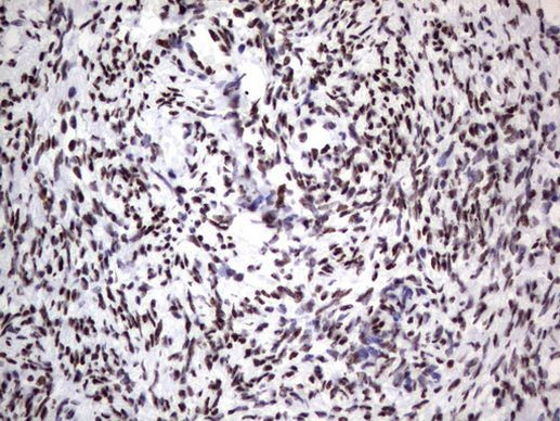 DDX56 Antibody in Immunohistochemistry (Paraffin) (IHC (P))