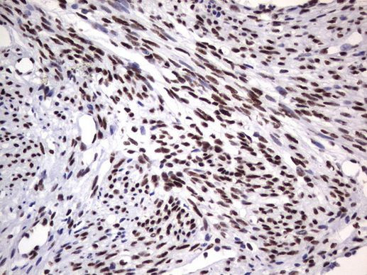 DDX56 Antibody in Immunohistochemistry (Paraffin) (IHC (P))