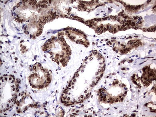 DDX56 Antibody in Immunohistochemistry (Paraffin) (IHC (P))