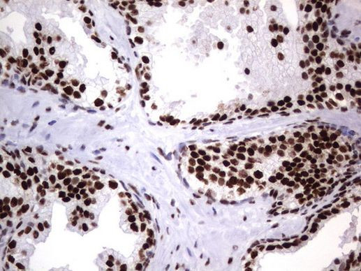 DDX56 Antibody in Immunohistochemistry (Paraffin) (IHC (P))