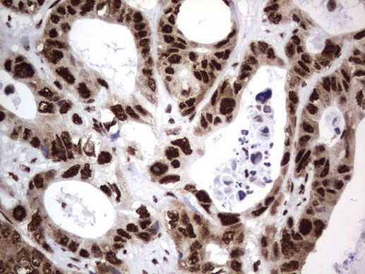 DDX56 Antibody in Immunohistochemistry (Paraffin) (IHC (P))