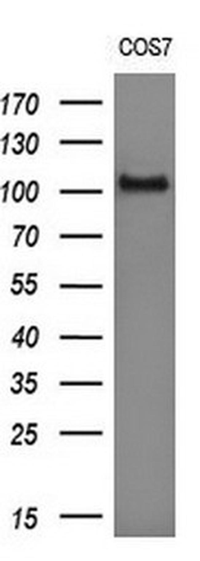 DDX58 Antibody in Western Blot (WB)