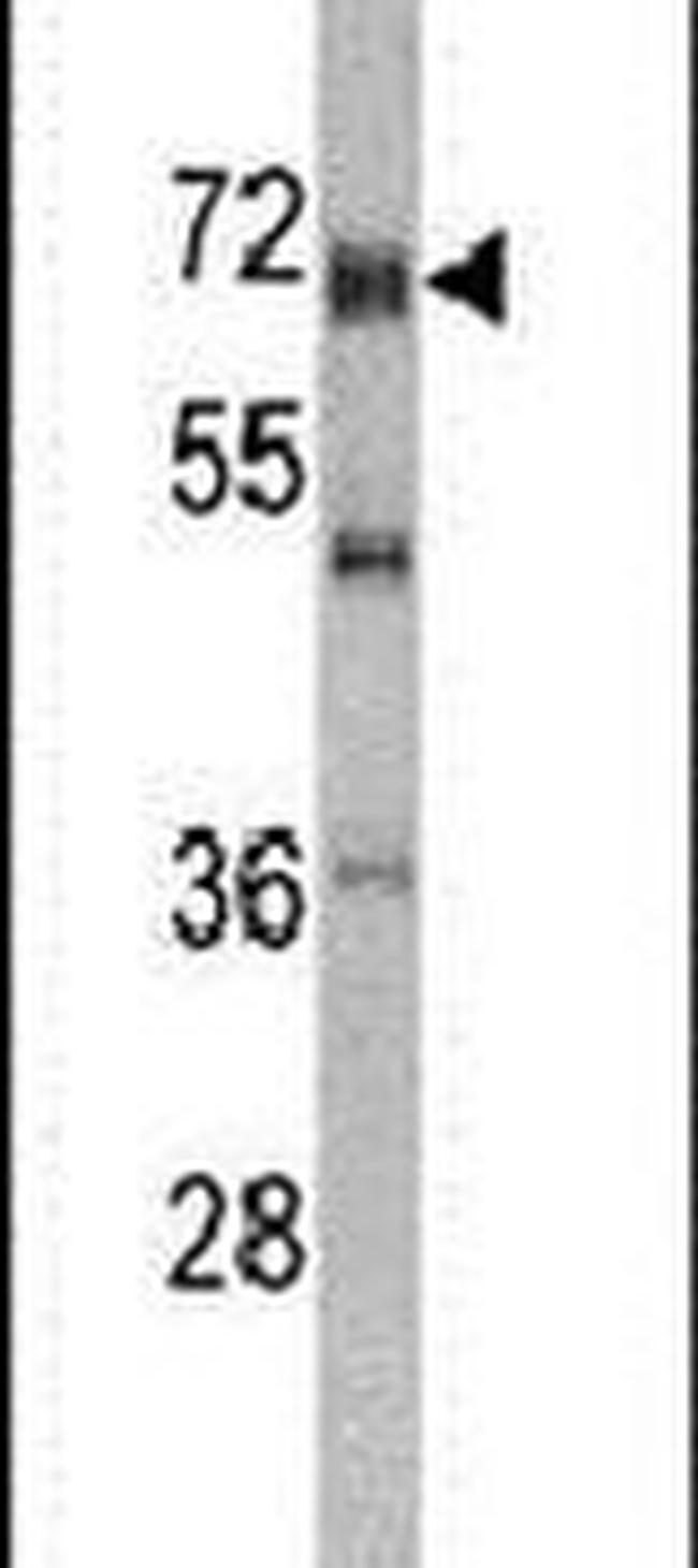 DDX5 Antibody in Western Blot (WB)