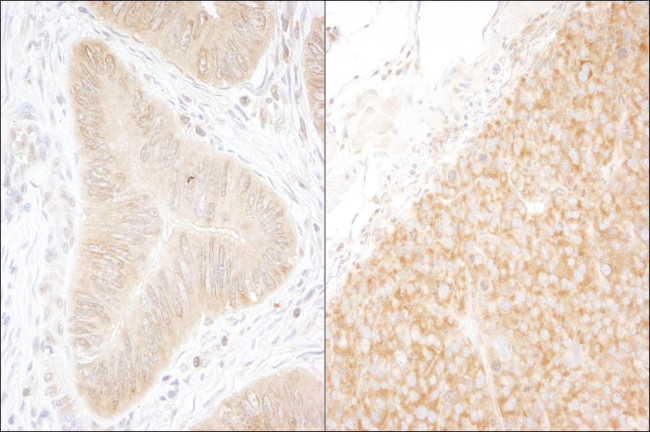 DDX6 Antibody in Immunohistochemistry (IHC)