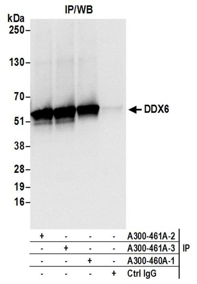 DDX6 Antibody in Western Blot (WB)