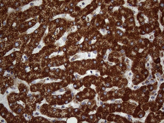 DECR1 Antibody in Immunohistochemistry (Paraffin) (IHC (P))