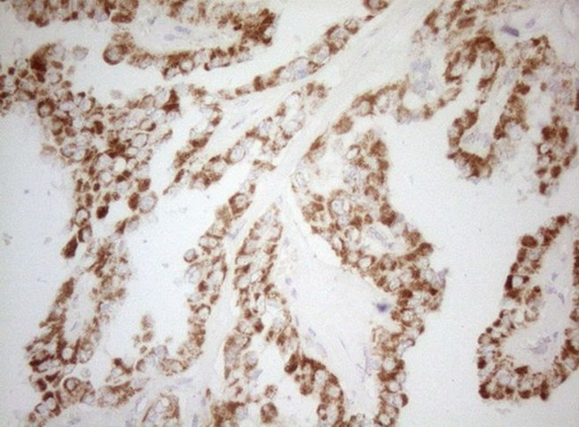 DECR1 Antibody in Immunohistochemistry (Paraffin) (IHC (P))