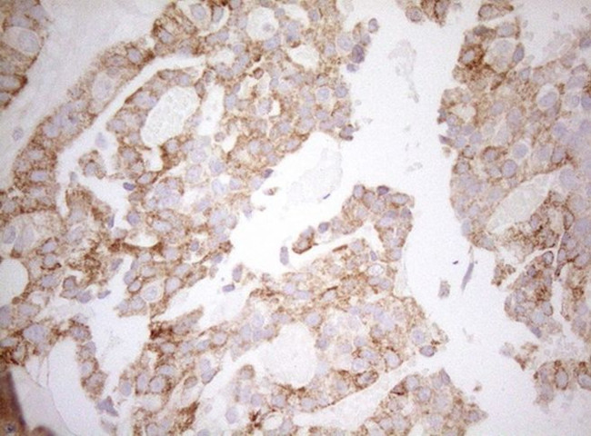 DECR1 Antibody in Immunohistochemistry (Paraffin) (IHC (P))