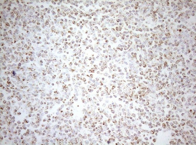 DECR1 Antibody in Immunohistochemistry (Paraffin) (IHC (P))