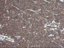 DEF6 Antibody in Immunohistochemistry (Paraffin) (IHC (P))