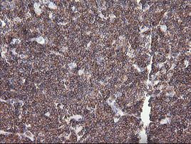 DEF6 Antibody in Immunohistochemistry (Paraffin) (IHC (P))