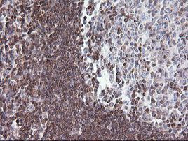 DEF6 Antibody in Immunohistochemistry (Paraffin) (IHC (P))