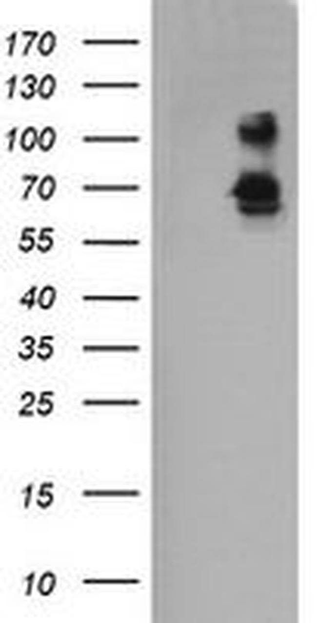 DEF6 Antibody in Western Blot (WB)