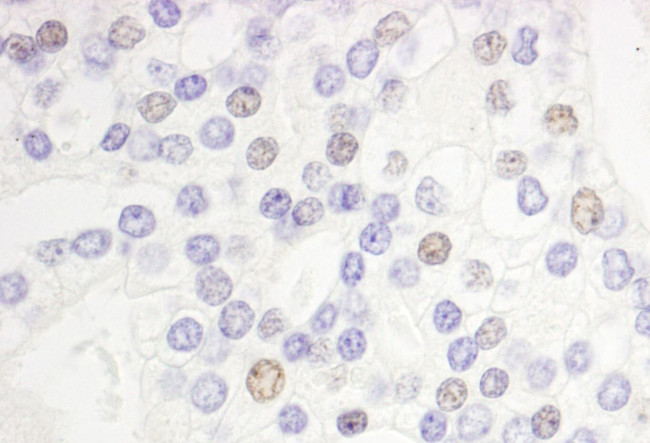 DEK Antibody in Immunohistochemistry (IHC)