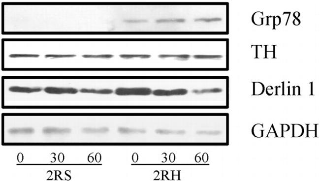 DERL1 Antibody in Western Blot (WB)