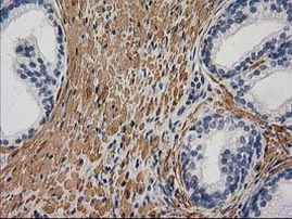 DES Antibody in Immunohistochemistry (Paraffin) (IHC (P))