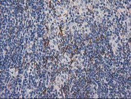 DES Antibody in Immunohistochemistry (Paraffin) (IHC (P))