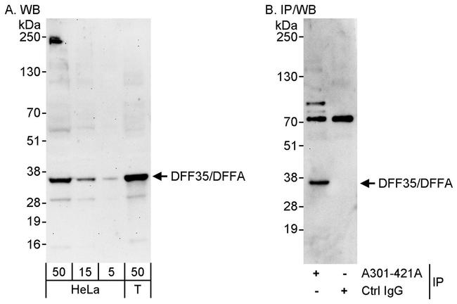 DFF35/DFFA Antibody in Western Blot (WB)
