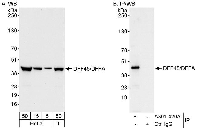 DFF45/DFFA Antibody in Western Blot (WB)