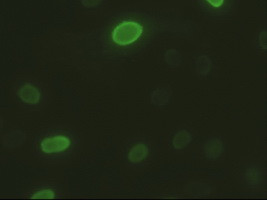 DFF45 Antibody in Immunocytochemistry (ICC/IF)