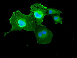 DFF45 Antibody in Immunocytochemistry (ICC/IF)