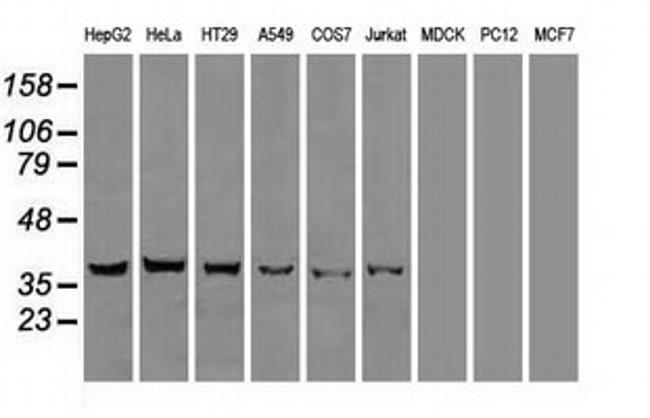 DFF45 Antibody in Western Blot (WB)