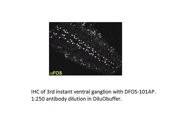 DFos Antibody in Immunohistochemistry (IHC)