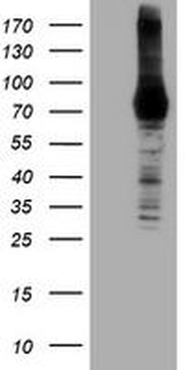 DGKA Antibody in Western Blot (WB)