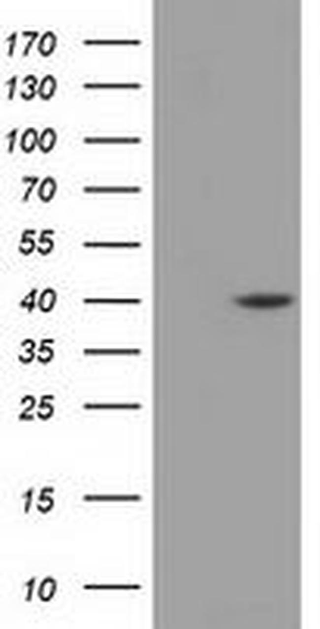 DHPS Antibody in Western Blot (WB)