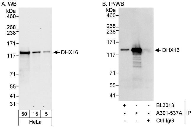 DHX16 Antibody in Western Blot (WB)