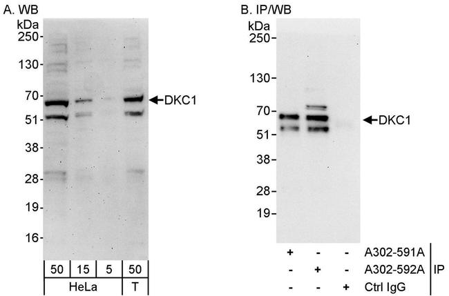 DKC1 Antibody in Western Blot (WB)