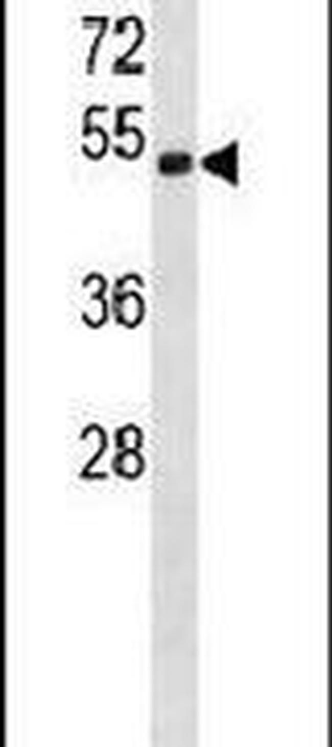 DKK3 Antibody in Western Blot (WB)