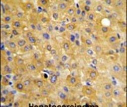 DLG7 Antibody in Immunohistochemistry (IHC)