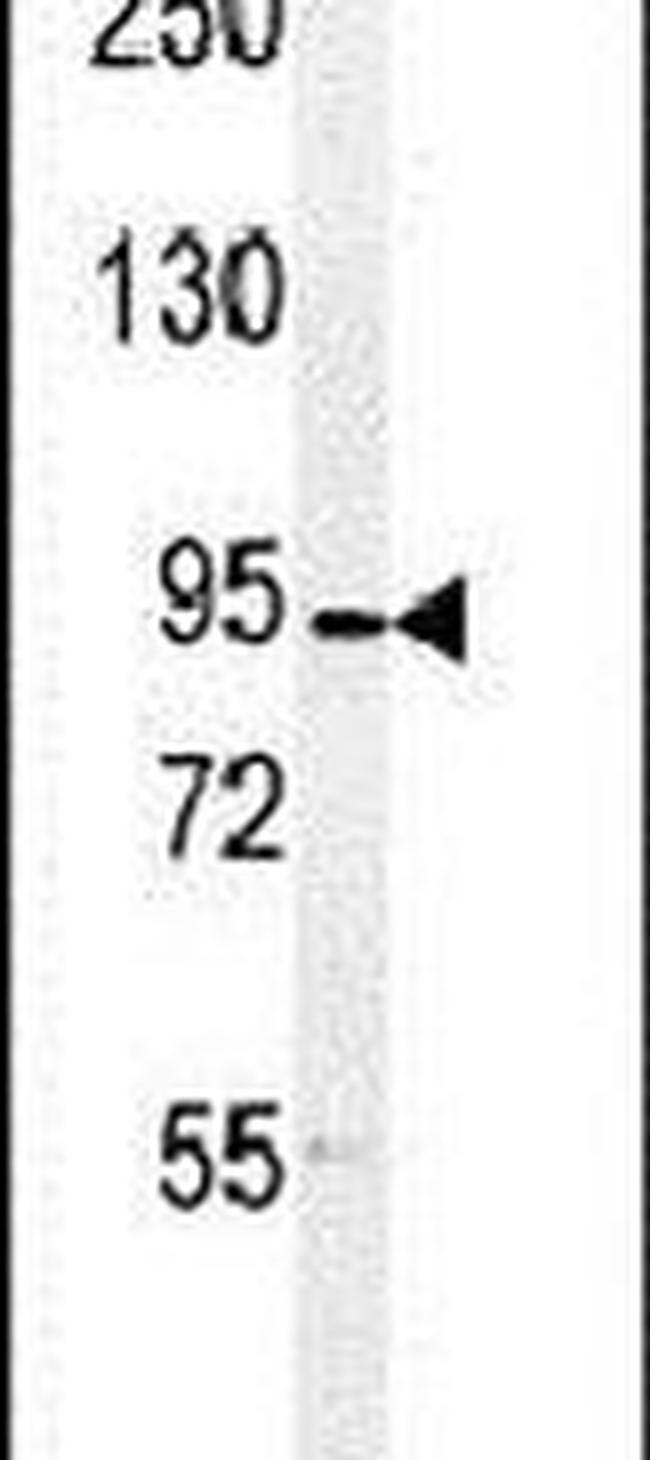 DLG7 Antibody in Western Blot (WB)