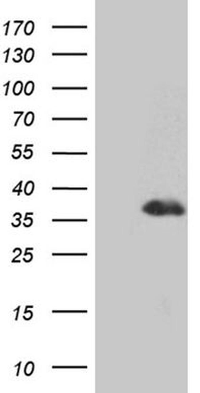 DLX1 Antibody in Western Blot (WB)