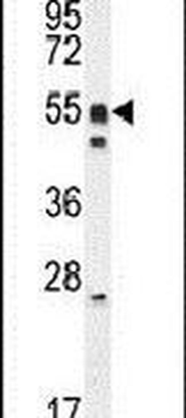 DMRTA1 Antibody in Western Blot (WB)