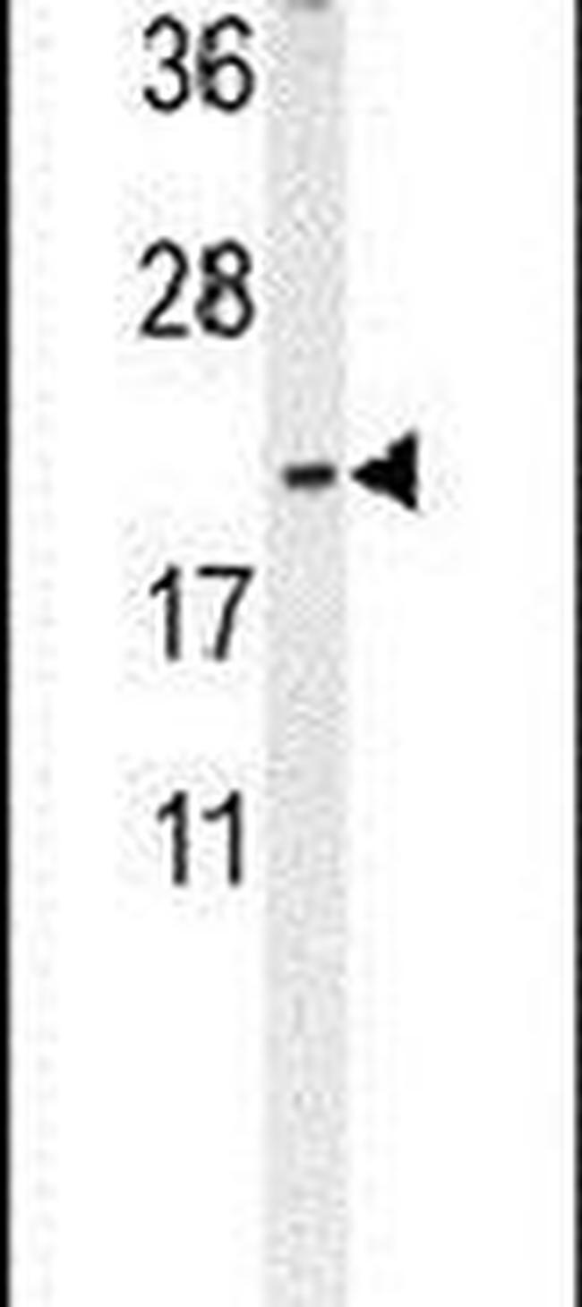 DMRTC1 Antibody in Western Blot (WB)