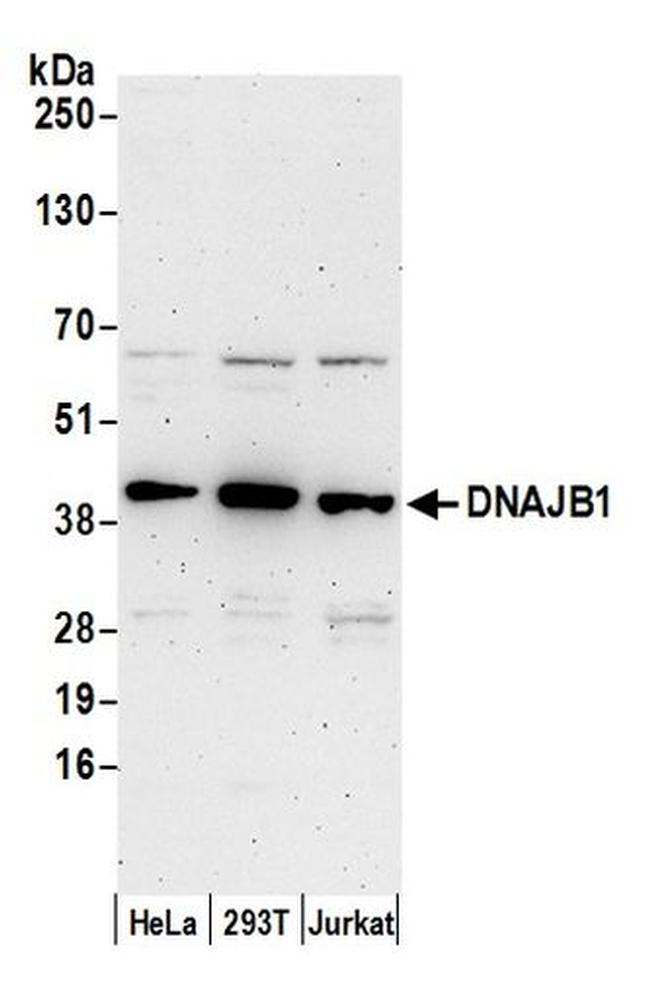 DNAJB1/Hsp40 Antibody in Western Blot (WB)