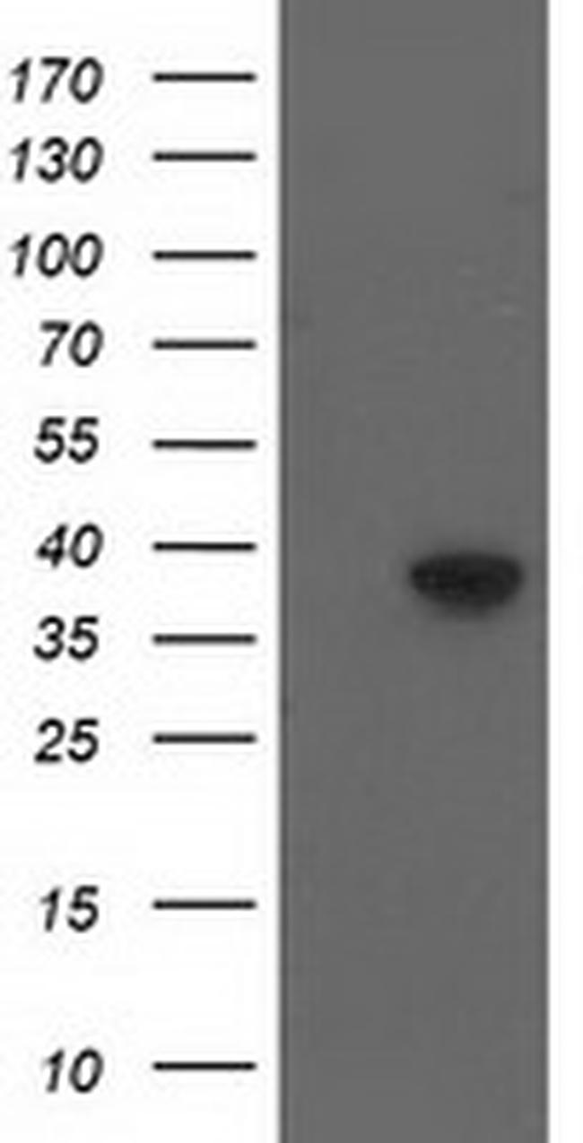 DNAJB1 Antibody in Western Blot (WB)