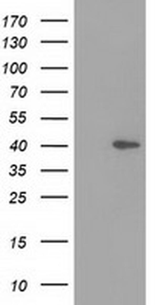 DNAJB1 Antibody in Western Blot (WB)