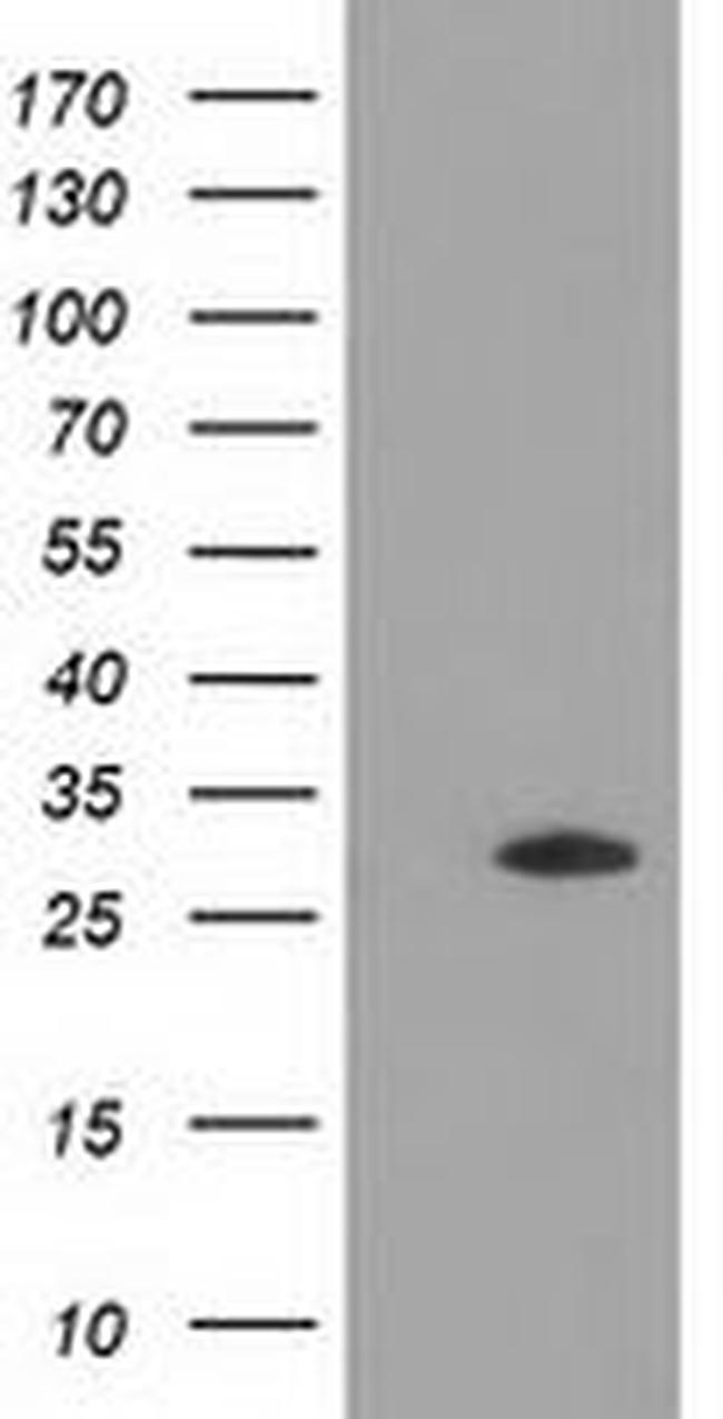 DNAJB2 Antibody in Western Blot (WB)