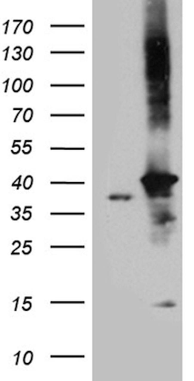 DNAJB4 Antibody in Western Blot (WB)