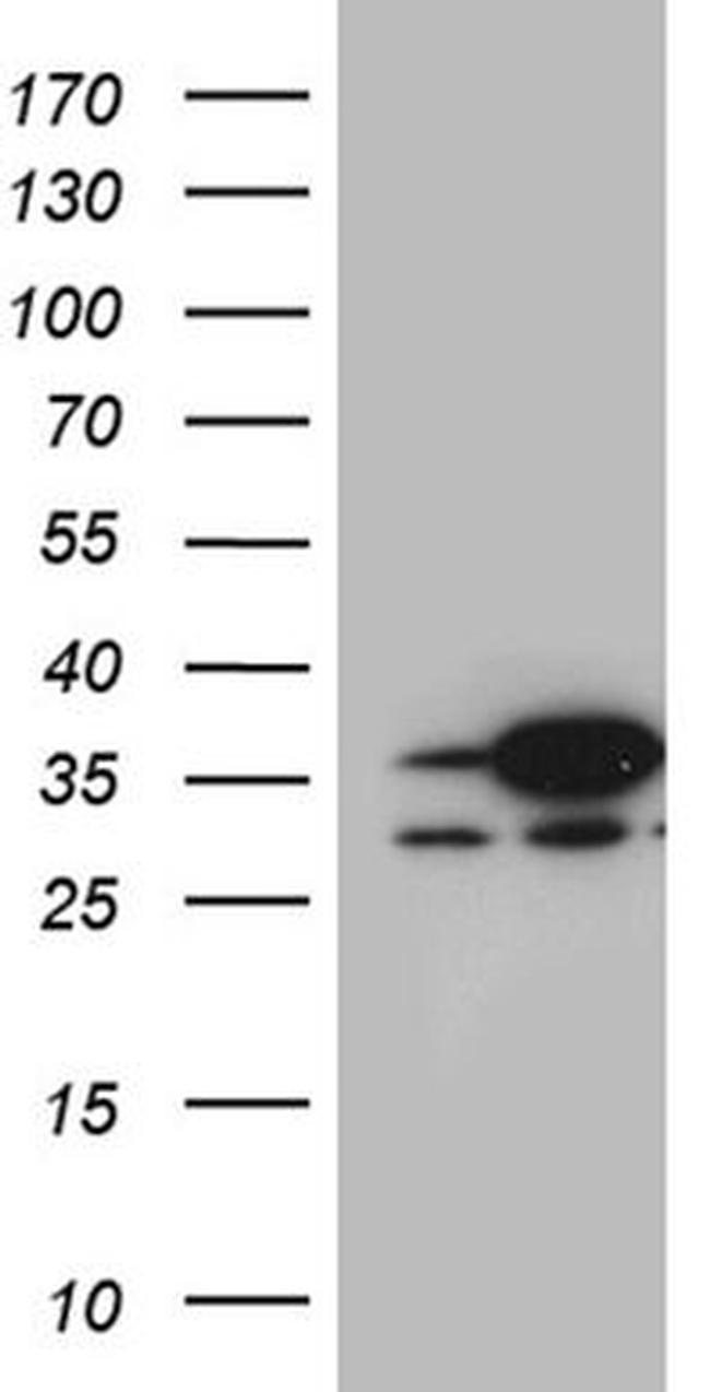 DNAJB6 Antibody in Western Blot (WB)