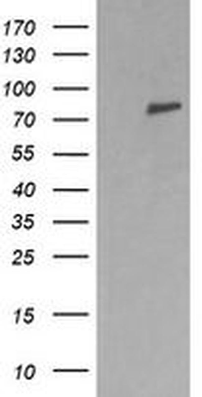 DNM1L Antibody in Western Blot (WB)