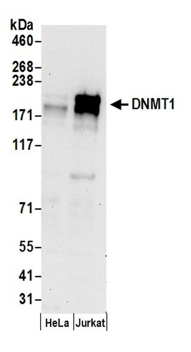 DNMT1 Antibody in Western Blot (WB)