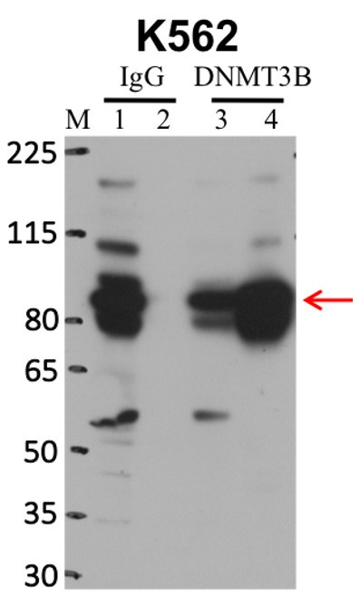 DNMT3B Antibody in Immunoprecipitation (IP)