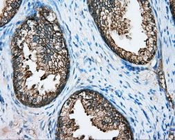 DNTTIP1 Antibody in Immunohistochemistry (Paraffin) (IHC (P))