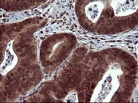 DOCK8 Antibody in Immunohistochemistry (Paraffin) (IHC (P))