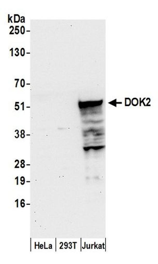 DOK2 Antibody in Western Blot (WB)