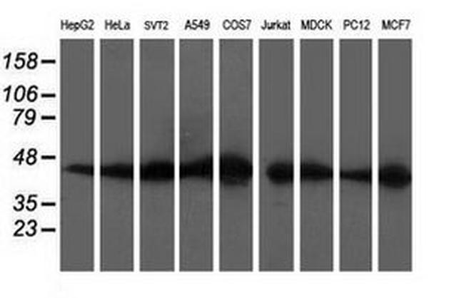 DOK2 Antibody in Western Blot (WB)